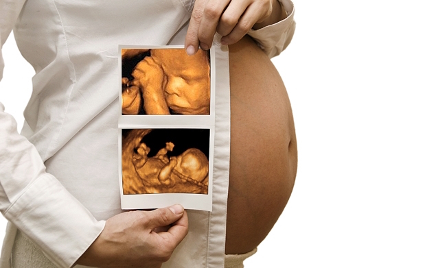 Ecografia 4d Ver Para Sentir Rodriguez Rubio